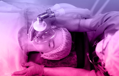 Nitrous Oxide Conscious Sedation